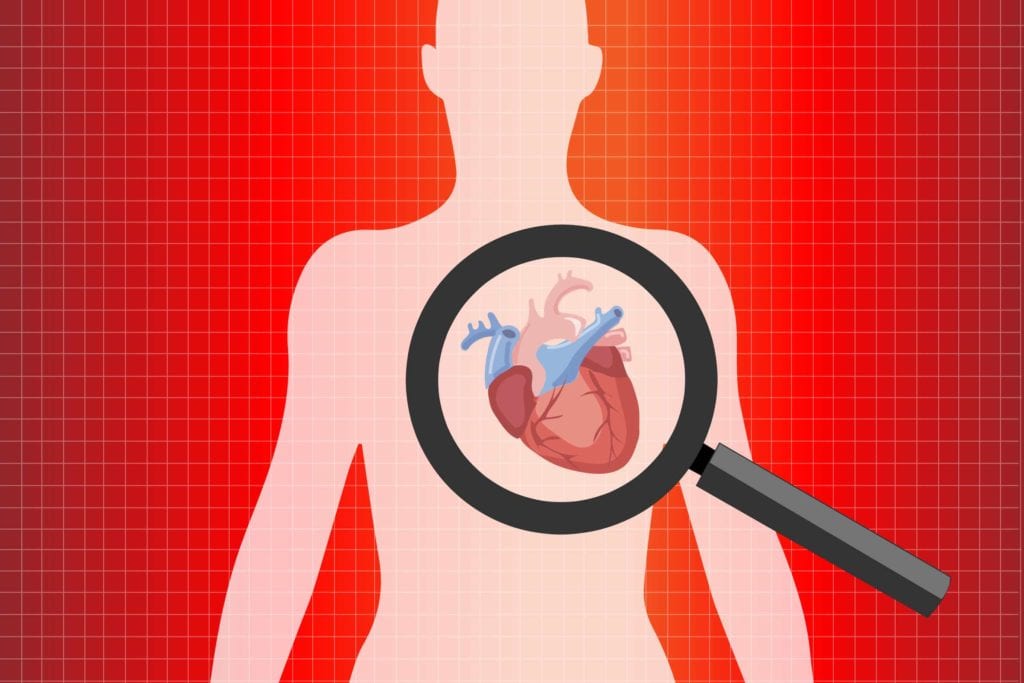 COVID-19 and Heart Disease