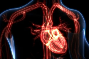 Myocarditis