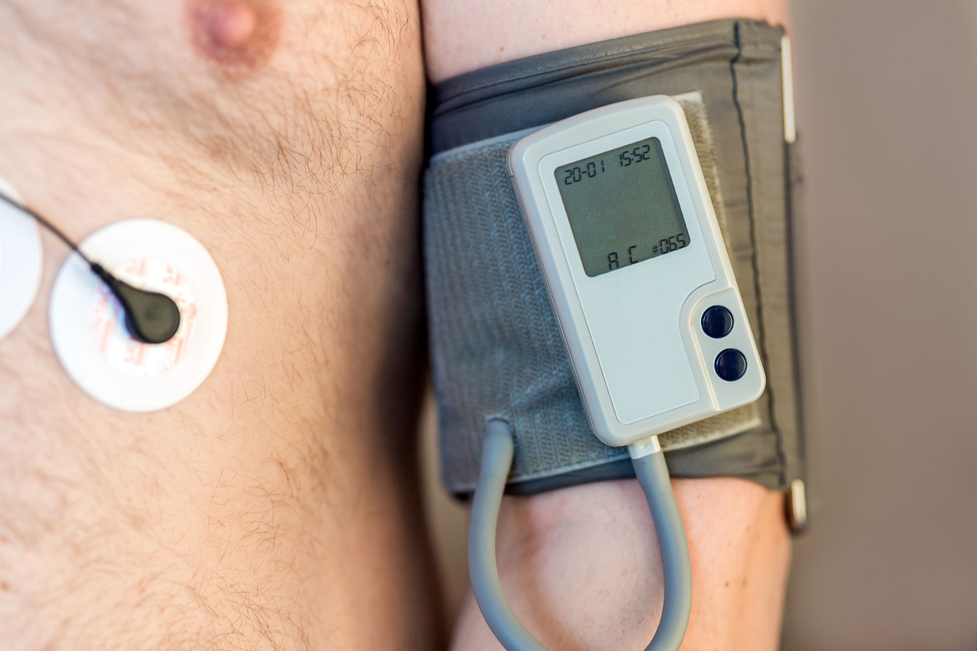 Ambulatory-blood-pressure-monitoring