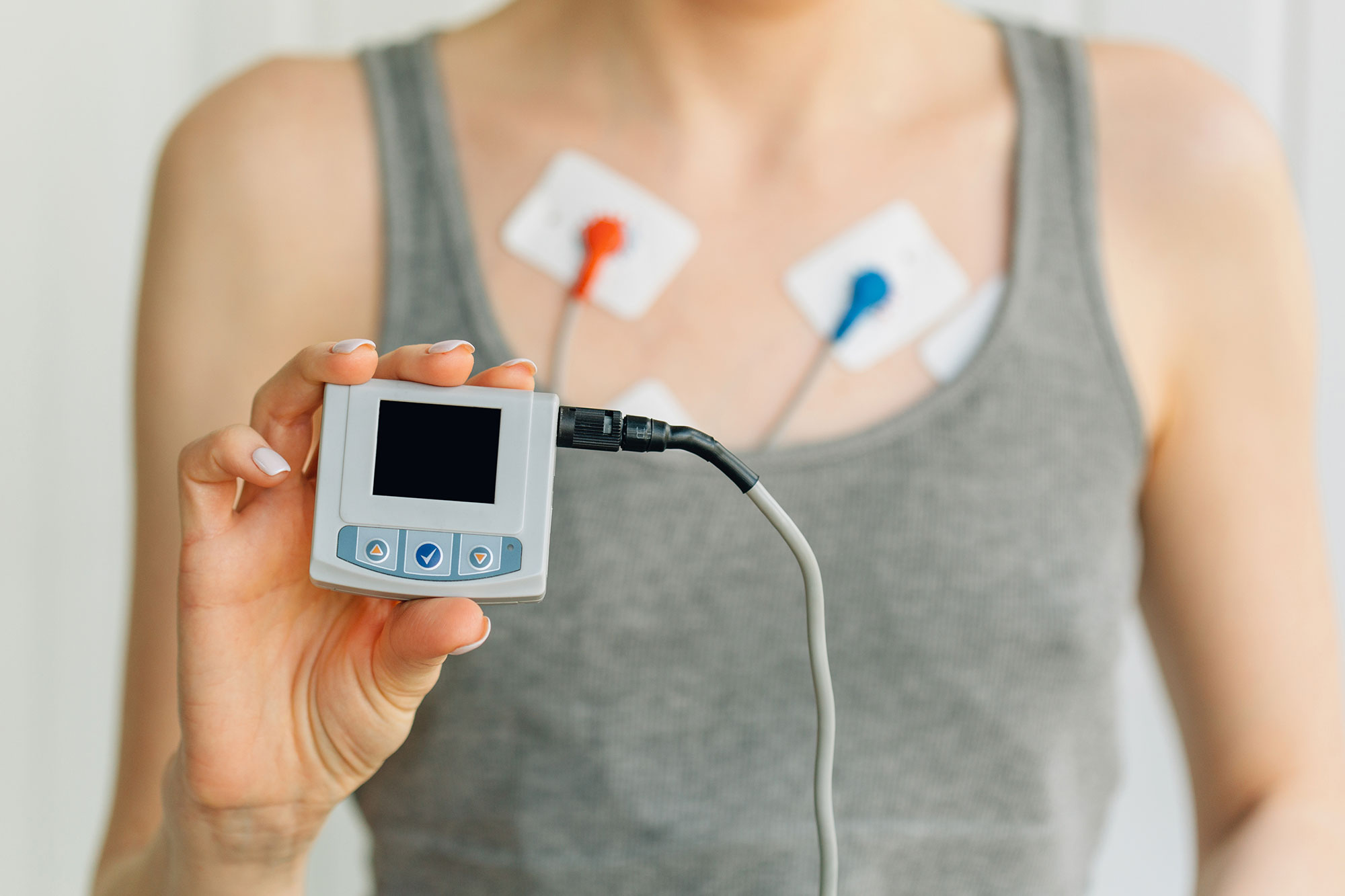 remote arrhythmia monitoring