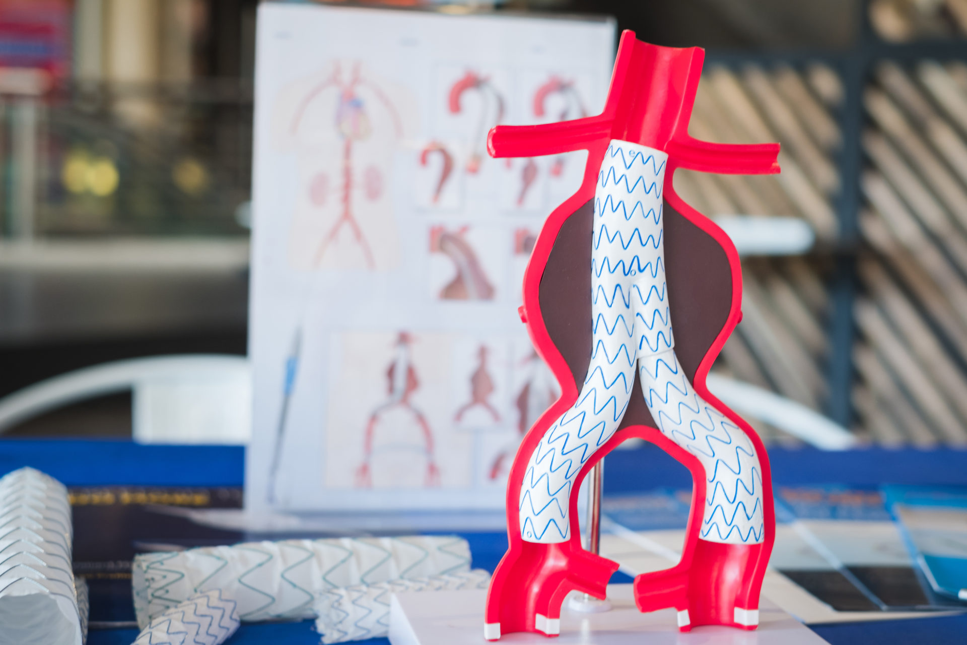 model of endovascular aneurysm repair (evar) for peoples educati